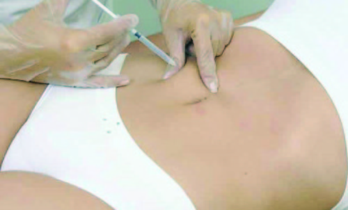 Entre os procedimentos estão as Aplicações de Enzimas para ajudar no combate da gordura localizada e da celulite